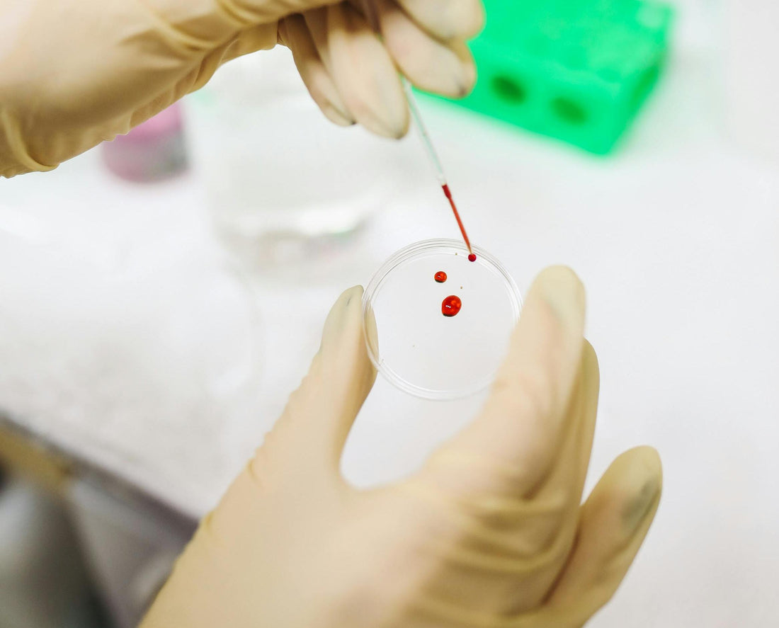 Neuer Bluttest für die Diagnose von Endometriose