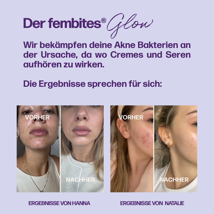 HORMONE SKIN COMPLETE (mit femcaps®)