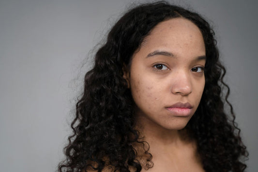 6 versteckte Ursachen für Breakouts, die du vielleicht übersiehst