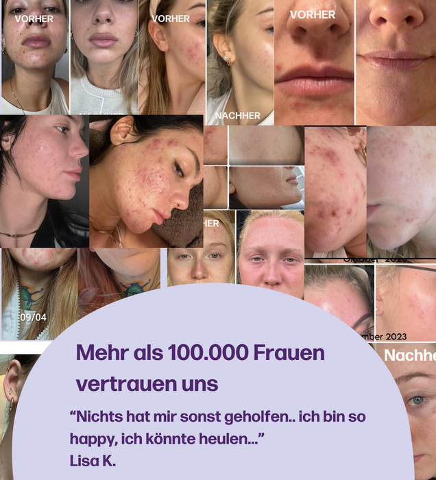 femcaps SKIN GLOW (can)