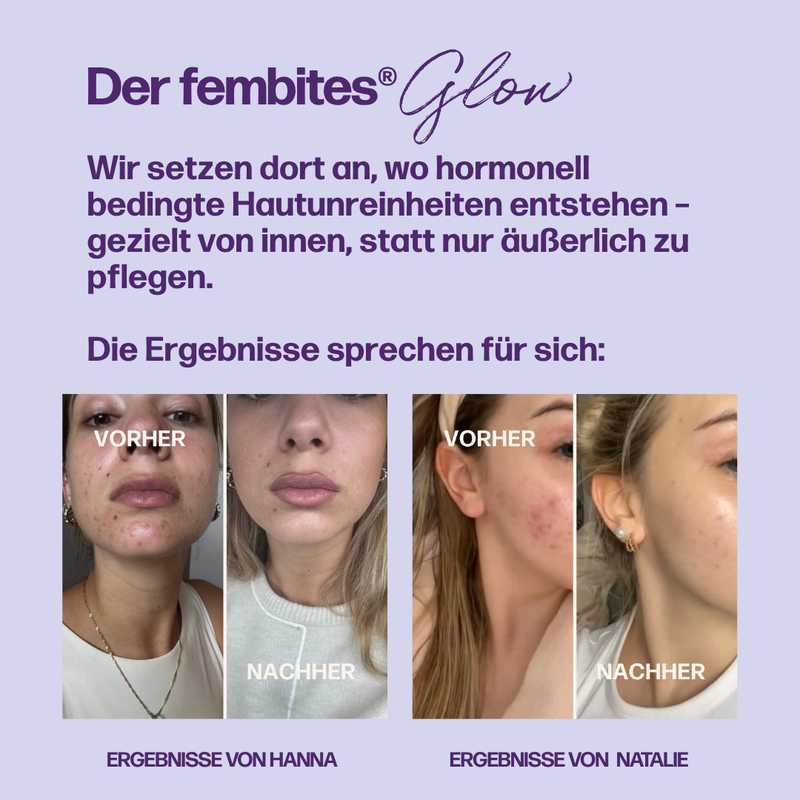 HORMONE SKIN COMPLETE (mit fempow®)
